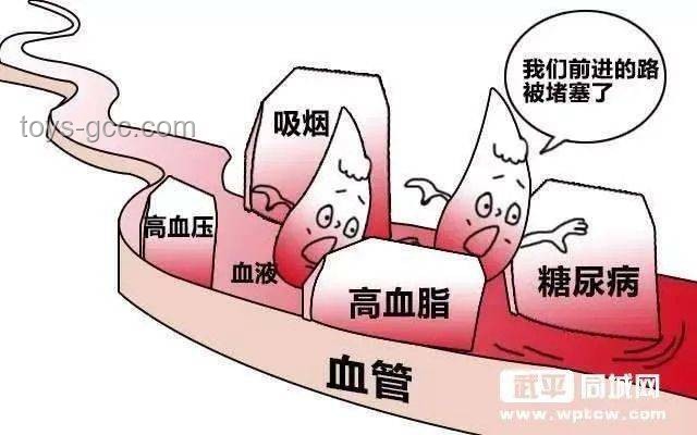 34岁网红村花突发脑梗警示，了解脑梗知识很重要